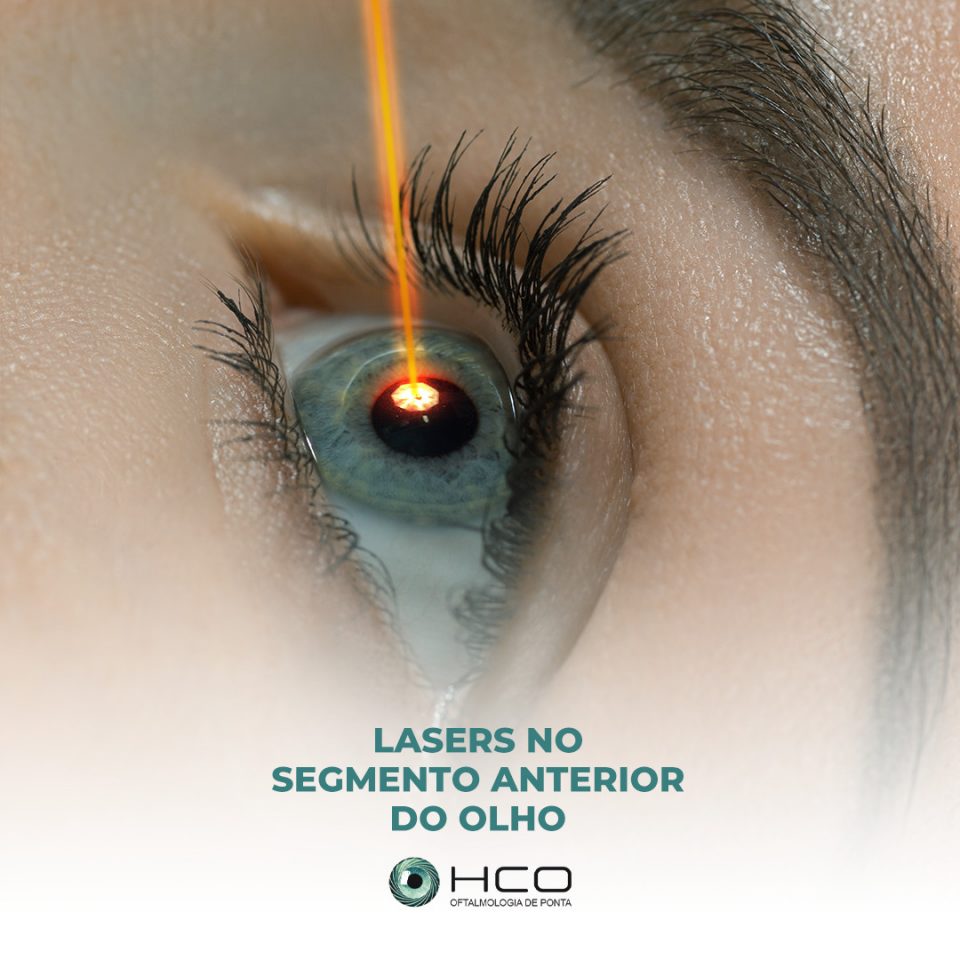 Lasers no segmento anterior do olho
