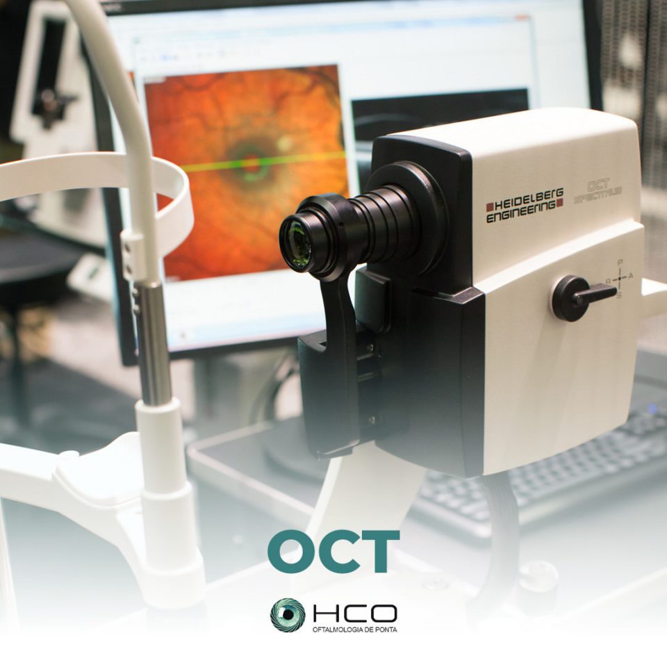 OCT ou Tomografia de Coerência Óptica