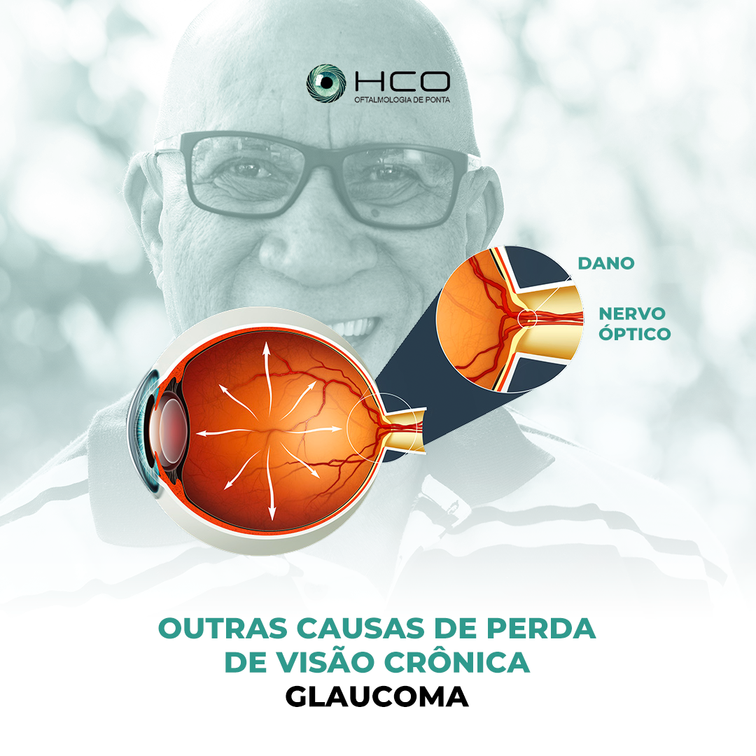 Outras causas de Perda de Visão Crônica - Glaucoma