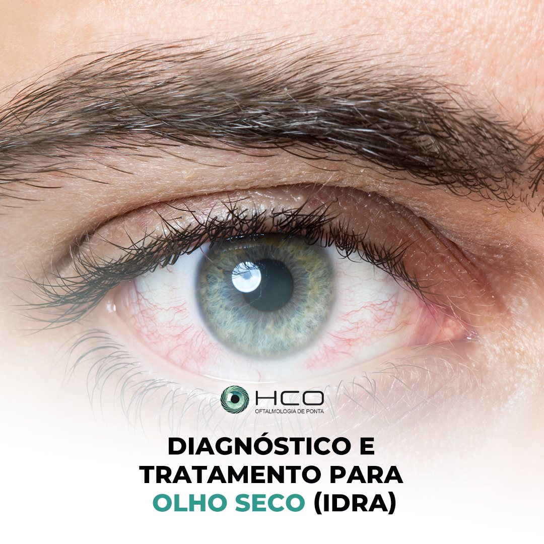 Diagnóstico e tratamento para olho seco (IDRA)