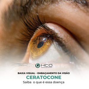 Baixa visual - embaçamento da visão - Ceratocone