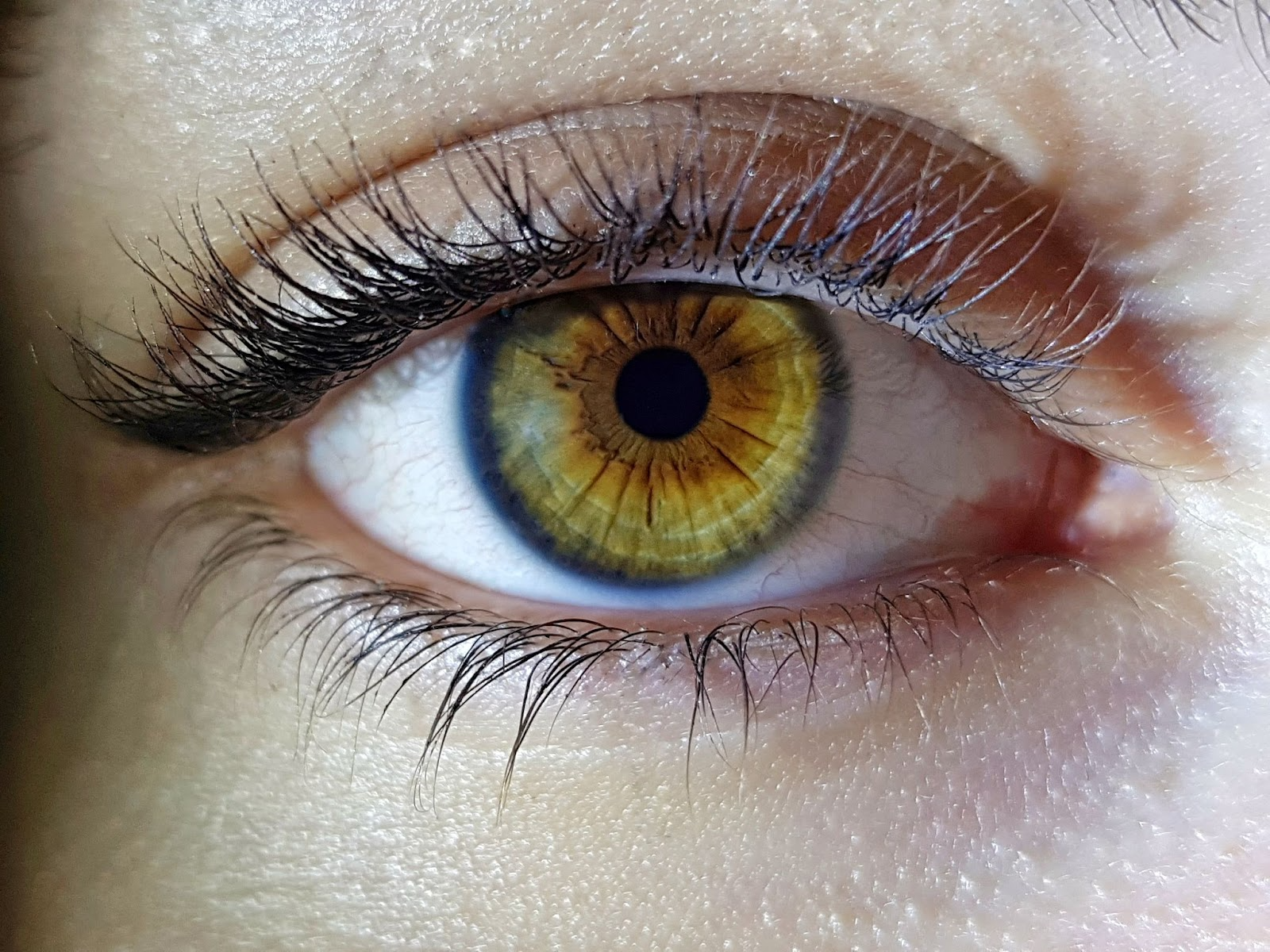 Quais são as diferenças entre SMILE, LASIK E PRK?
